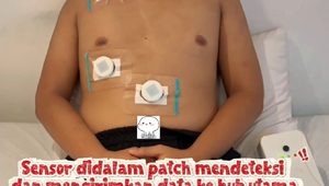 Penggunaan RespiraTB. (foto : istimewa)